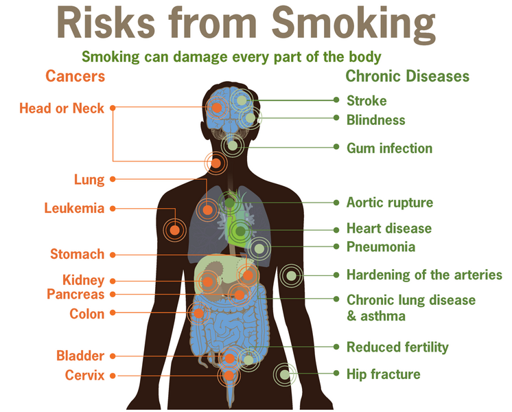 File:Risks form smoking-smoking can damage every part of the body.png