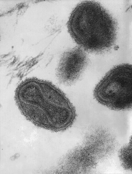 File:Smallpox virus virions TEM PHIL 1849.JPG
