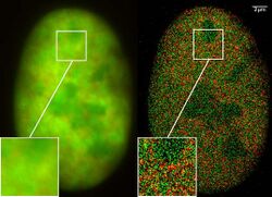 GFP Superresolution Christoph Cremer.JPG