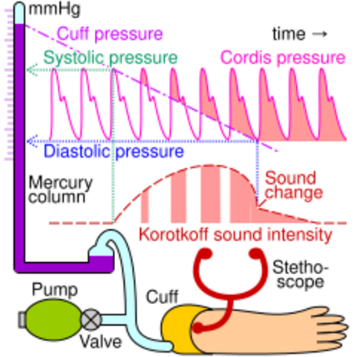 File:Blood pressure measurement principle.svg