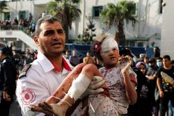 A man carrying a bloodied and bandaged child.