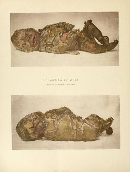 File:Illustrated Medicine and Surgery (1888) (14784247353).jpg
