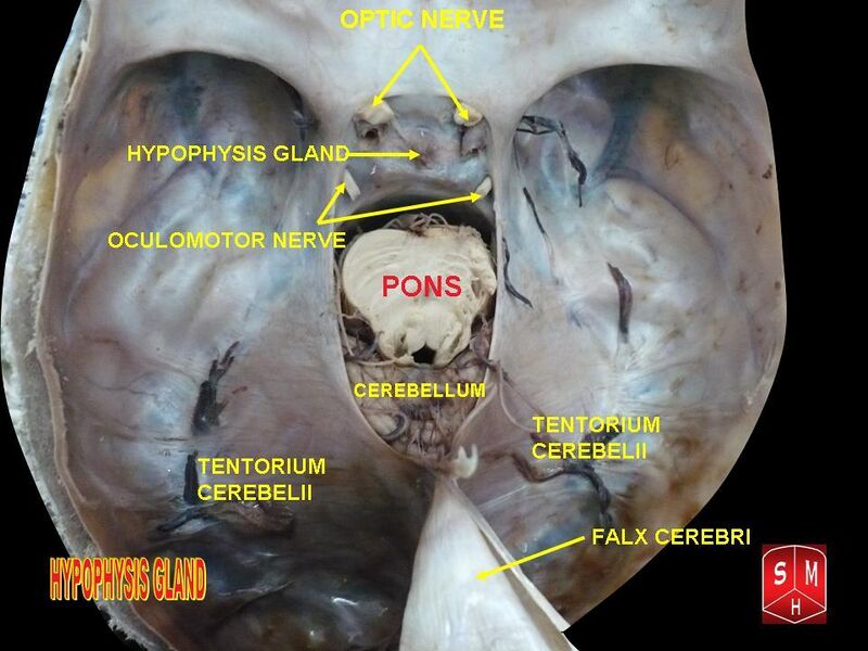 File:Hypophyseal gland.jpg