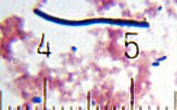 "Lactobacillus delbrueckii" subsp. "bulgaricus" from a sample of yogurt. Numbered ticks are 10 μm apart.