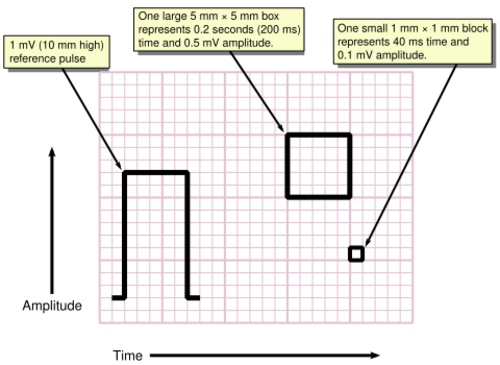 Measuring time and voltage with ECG graph paper