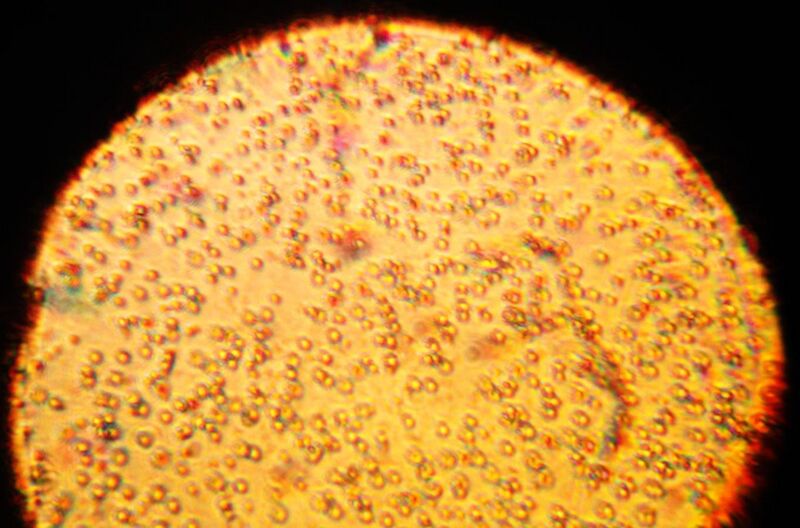 File:A microscopy image of a sample of human breast milk.JPG