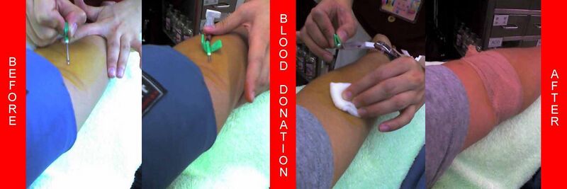 File:Blood donation needle.jpg