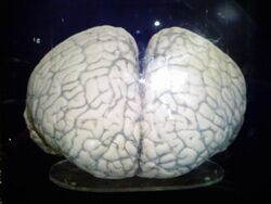 Photo of dual-hemisphered brain