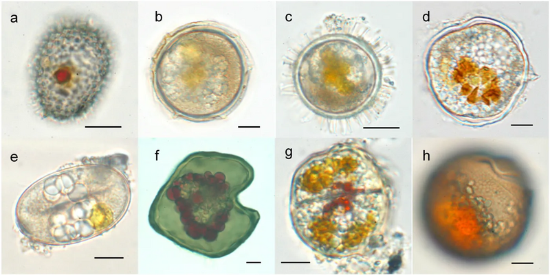 File:Resting cysts of dinoflagellates.webp