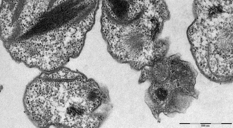 File:Diplorickettsia massiliensis Strain 20B bacteria grown in XTC-2 cells Transmission electron microscopy; staining with red ruthenium..jpg