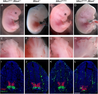 Embryos with mutation in Mks1krc, a cause of Meckel syndrome.png