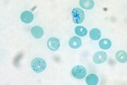 Microscopic image of red blood cells stained blue.