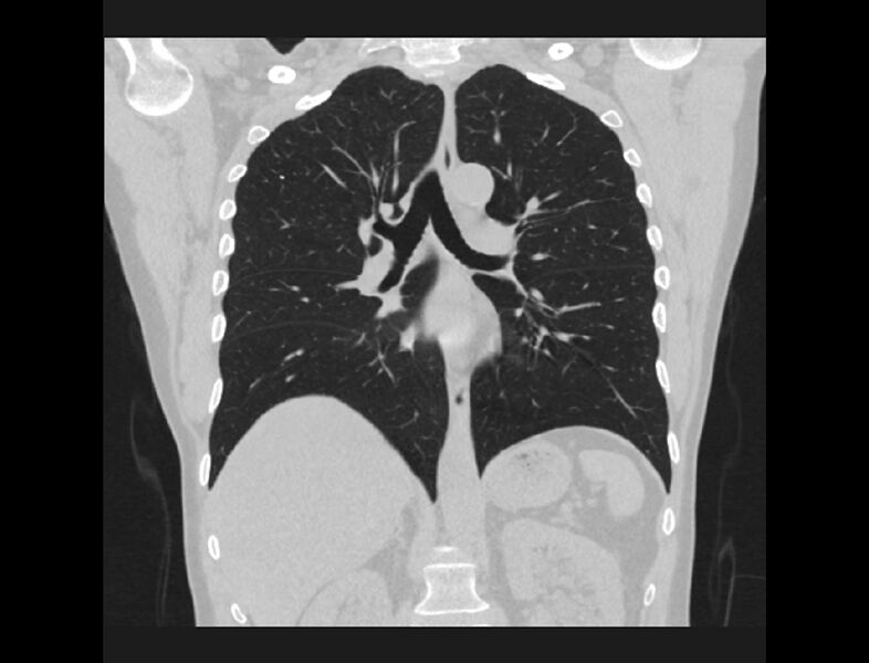 File:COR-2-STND-CHEST-LUNGS.jpg