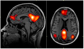 Default mode network-WRNMMC.jpg