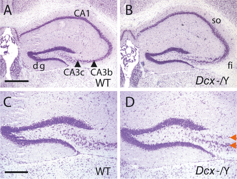 File:Morphological Abnormalities in the Dcx KO Hippocampus.png