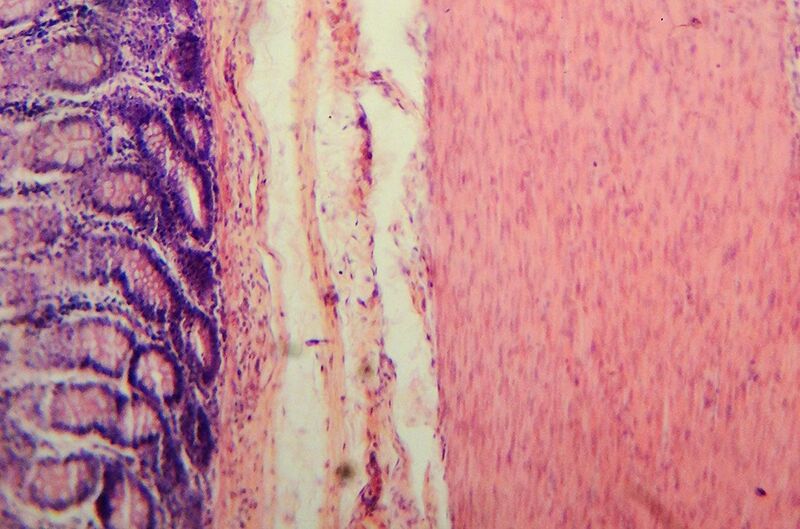File:Tissue layers of the small intestine (mucosa, submucosa & muscularis).jpg
