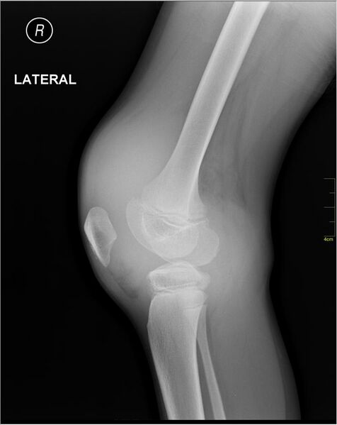 File:Medical X-Ray imaging JDG05 nevit.jpg