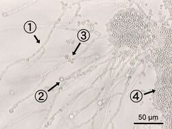 C albicans labeled.jpg