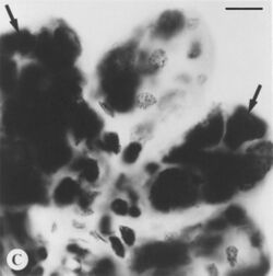 Black and white Feulgen stained microphotograph depicting intact tick salivary glands infected by deer tick virus. Hypotrophied salivary acinus filled with amorphous masses of pinkstaining (=Feulgen positive) material (arrows). Scale bar = 10 µm.