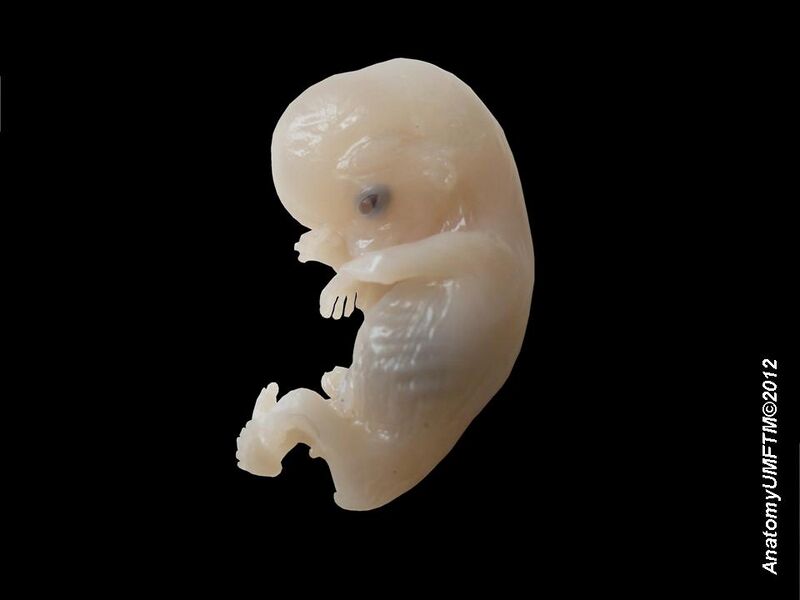 File:Human embryo.jpg