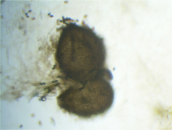 Sordaria fimicola perithecium (heterozygote) 40X.png
