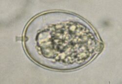 Microscopic view of sporangium of Phytophthora cactorum
