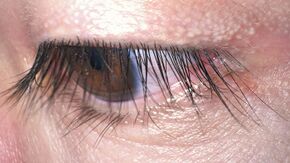 Human eyelashes.jpg