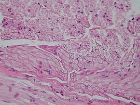 Peripheral nerve, cross section.jpg