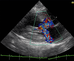 Echocardiography of hypertrophic-obstructive cardiomyopathy in a domestic cat.gif