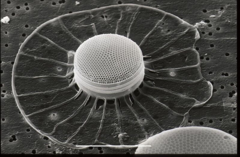 File:CSIRO ScienceImage 7632 SEM diatom.jpg