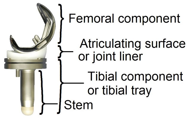 File:Knee prosthesis components.jpg
