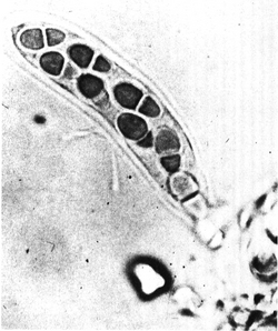 Bitunicate ascus and ascospores of Didymella rabiei.png