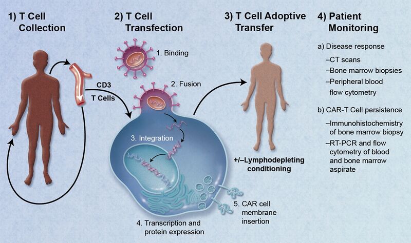 File:CAR-Engineered T-Cell Adoptive Transfer.jpg