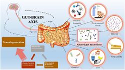 Gut-brain axis overview.jpg