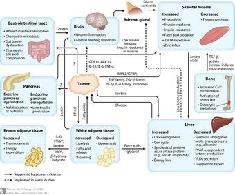 Cancer-associated cachexia diagram.jpg