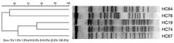 E. coli cluster analysis-pulsed-field gel electrophoresis.jpg
