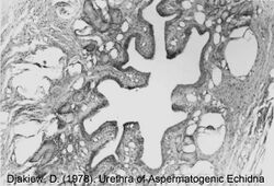 Figure 1. Aspermatogenic Echidna Prostate.jpg