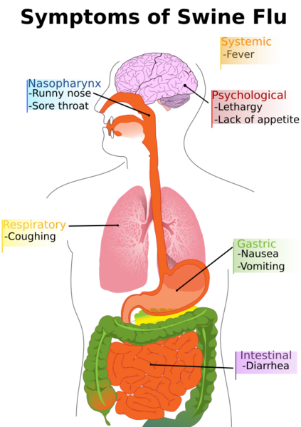 File:PD Diagram of swine flu symptoms EN.svg