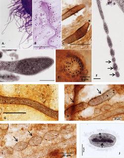 Parasite160019-fig1 - Chromidina spp. (Oligohymenophorea, Opalinopsidae), parasites of cephalopods of the Mediterranean Sea.png