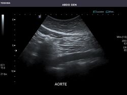 Abdominal Ultrasound Full Exam 47.jpg