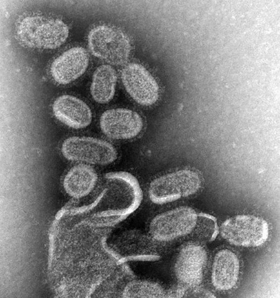 File:EM of influenza virus.jpg