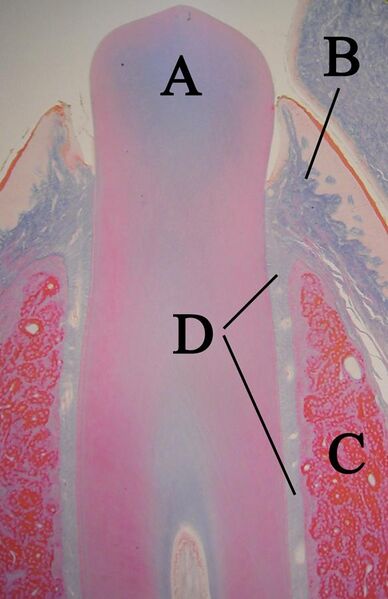 File:Eruptingtoothwithlabels11-24-05.jpg