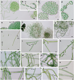 Microphotographs of heterocystous cyanobacteria.png