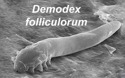 Demodex folliculorum SEM crop.jpg