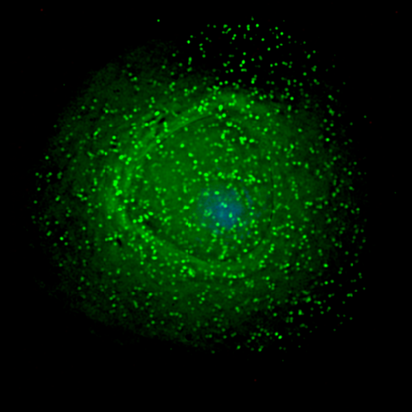 File:HIV on macrophage.png