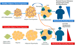 Adipose tissue expandability hypothesis.png