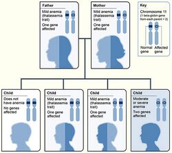 Thalassemia beta.jpg