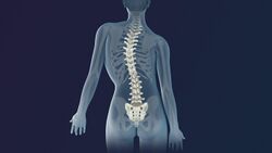 3D Medical Animation scoliosis Intervertibral Disc.jpg