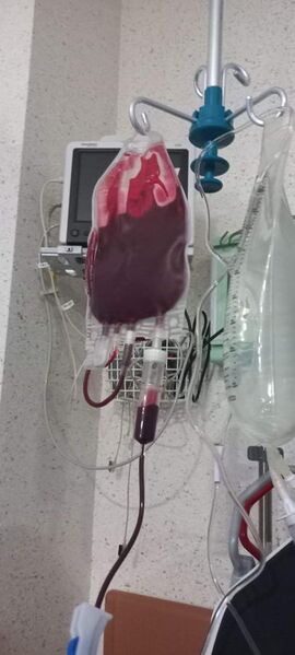 File:Blood unit during transfusion.jpg