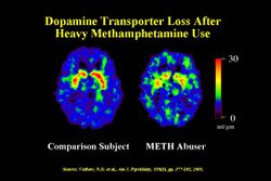 Dopamine Transporter Meth.jpg